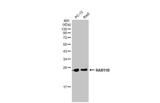 RAB11B Antibody in Western Blot (WB)