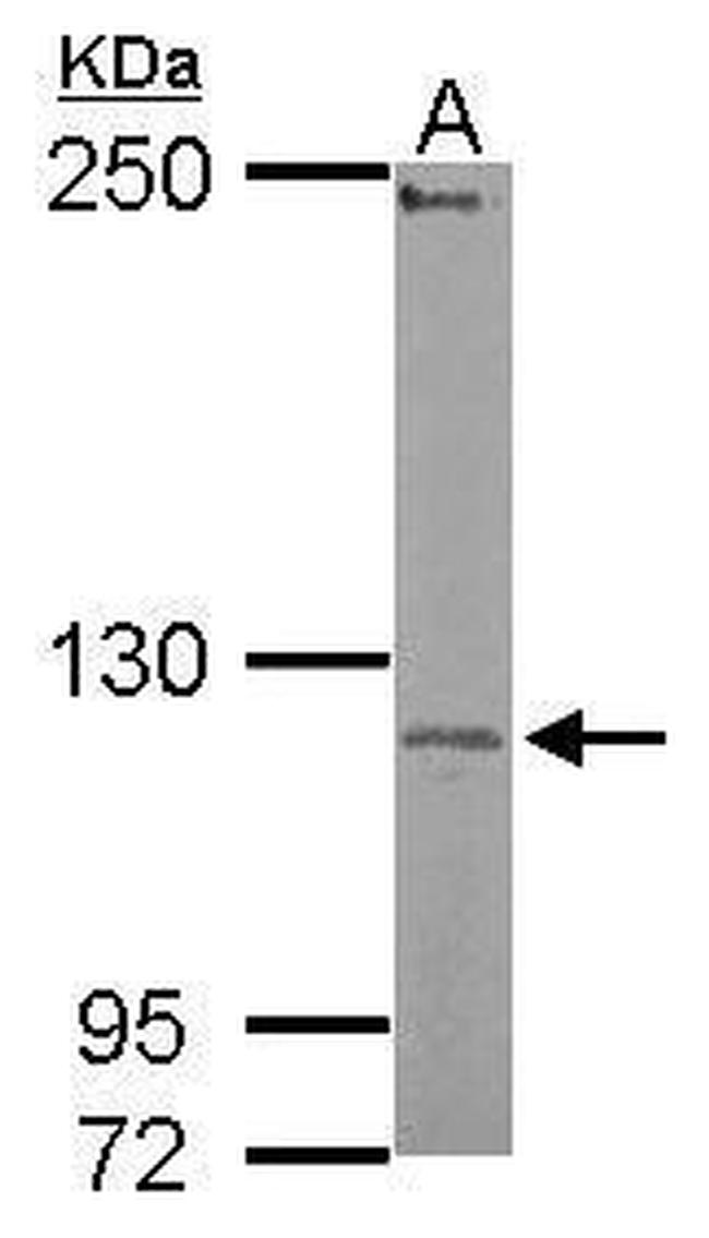 UBE3C Antibody in Western Blot (WB)