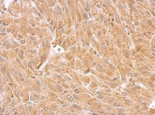 Septin-8 Antibody in Immunohistochemistry (Paraffin) (IHC (P))