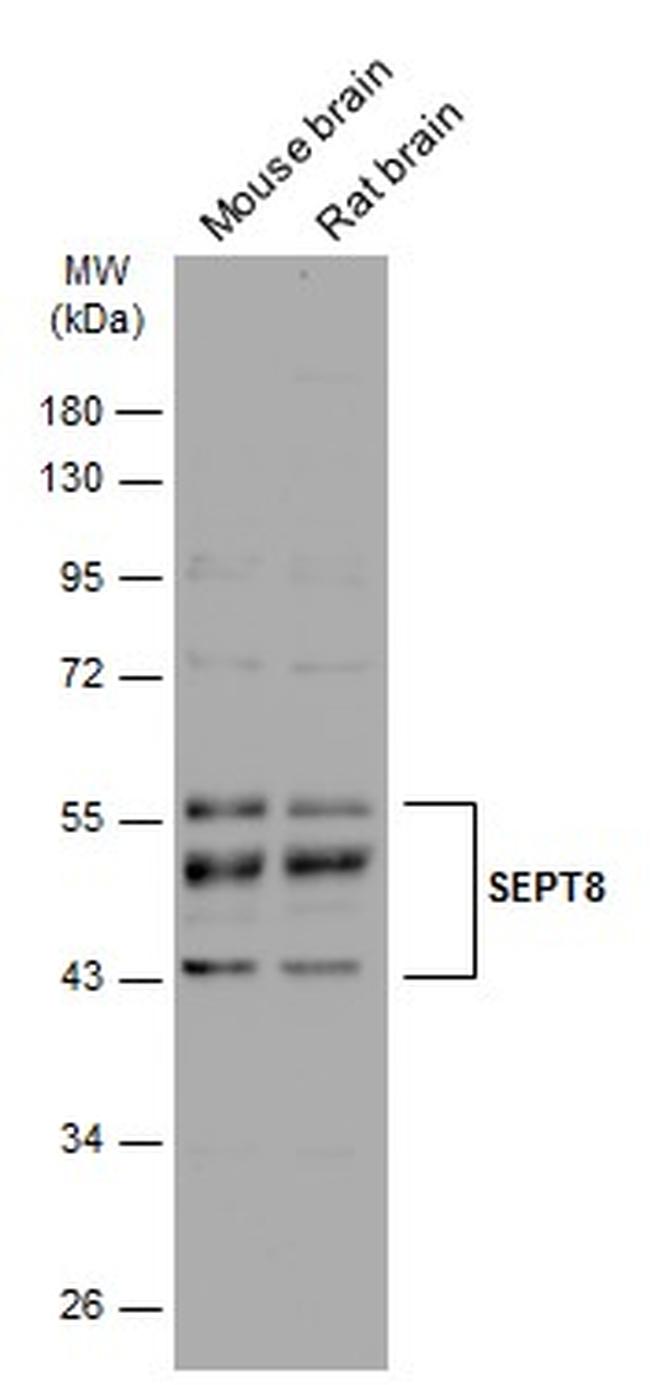 Septin-8 Antibody in Western Blot (WB)