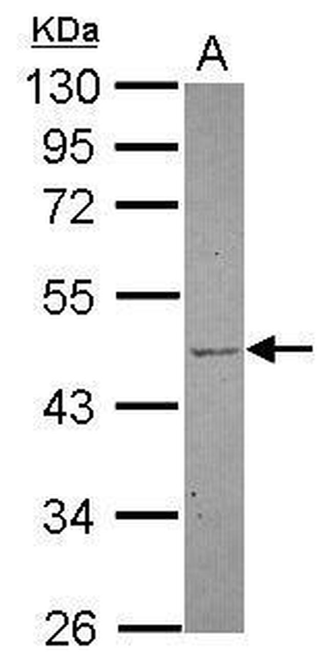 TBL2 Antibody in Western Blot (WB)