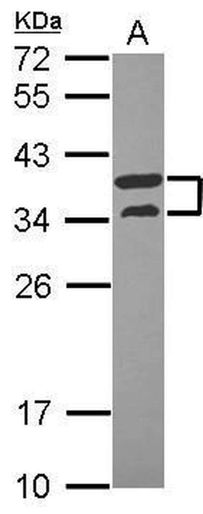 V-ATPase D Antibody in Western Blot (WB)