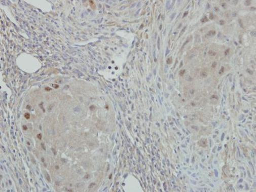 NAT10 Antibody in Immunohistochemistry (Paraffin) (IHC (P))