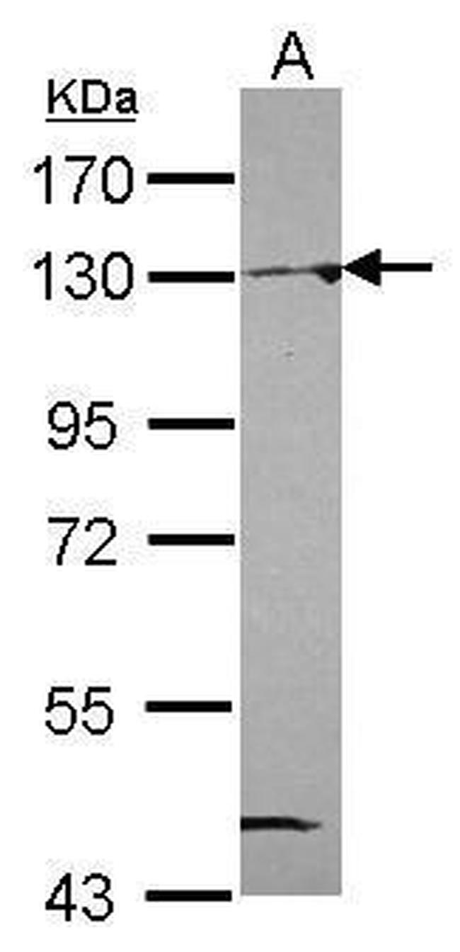 NAT10 Antibody in Western Blot (WB)