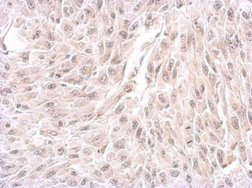 WDR19 Antibody in Immunohistochemistry (Paraffin) (IHC (P))