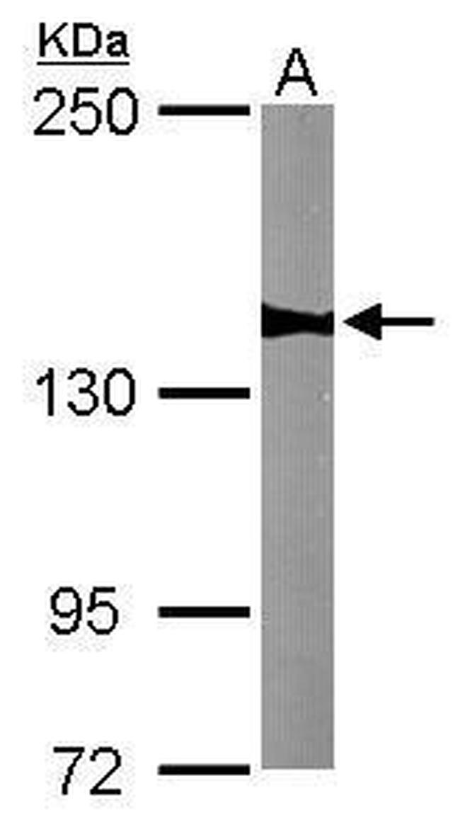 WDR19 Antibody in Western Blot (WB)