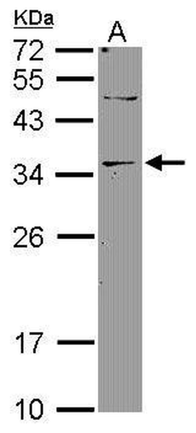 DNASE2B Antibody in Western Blot (WB)