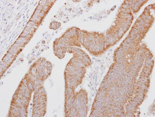 SMOC1 Antibody in Immunohistochemistry (Paraffin) (IHC (P))