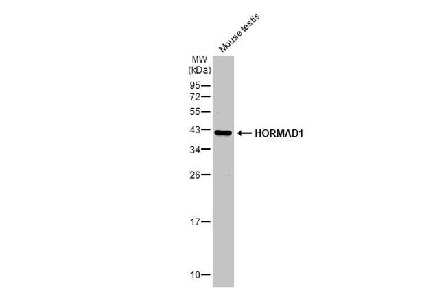 HORMAD1 Antibody in Western Blot (WB)