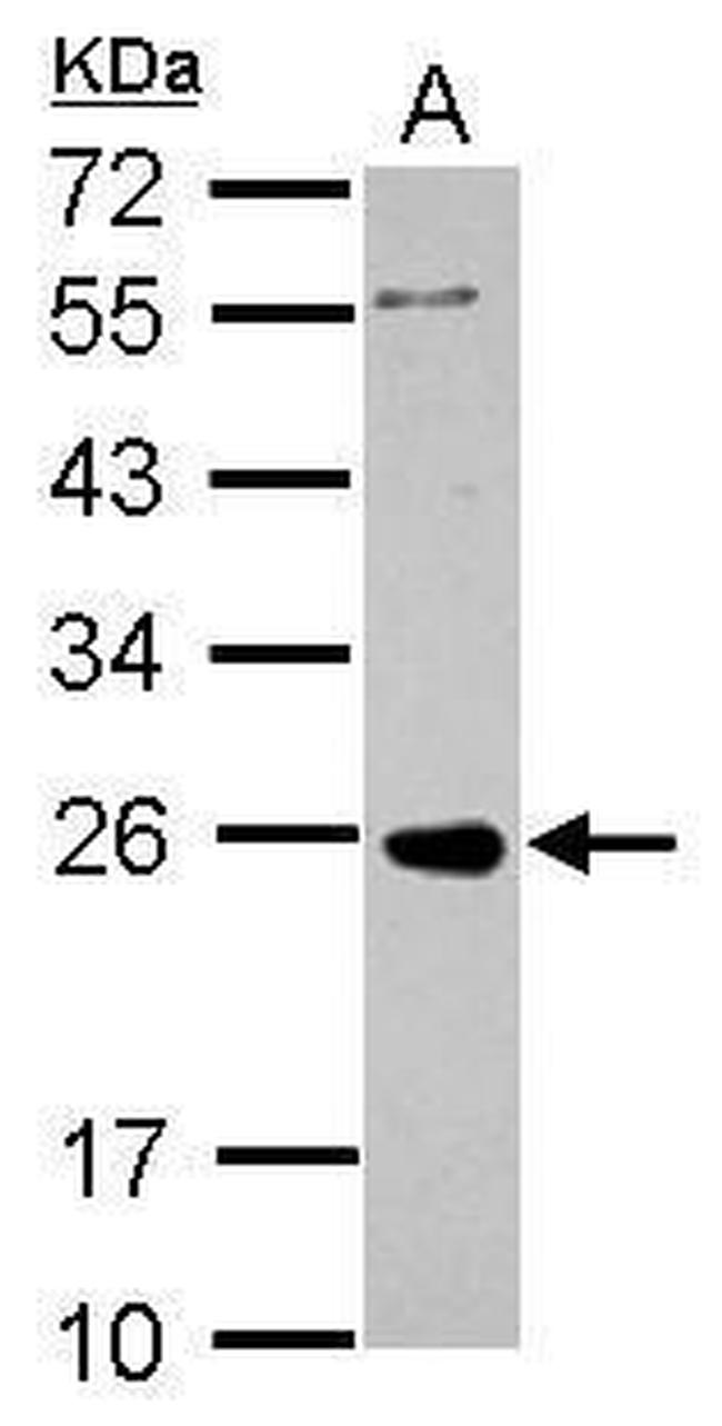 PRKCDBP Antibody in Western Blot (WB)