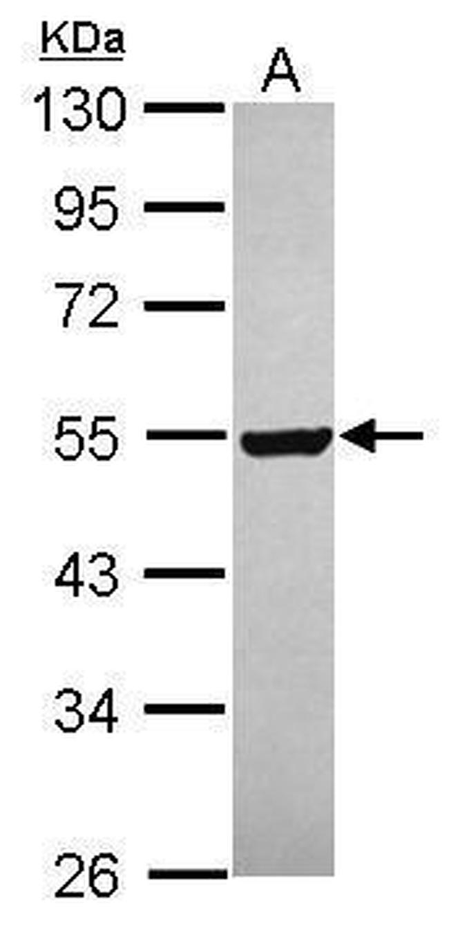 GABPB2 Antibody in Western Blot (WB)