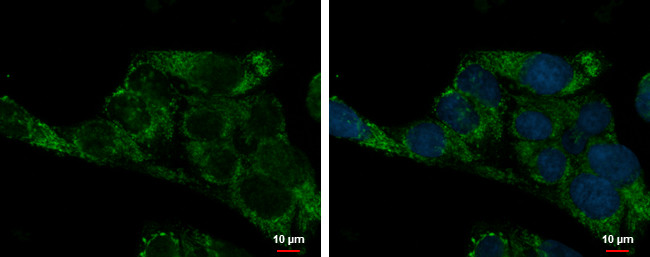 ADHFE1 Antibody in Immunocytochemistry (ICC/IF)