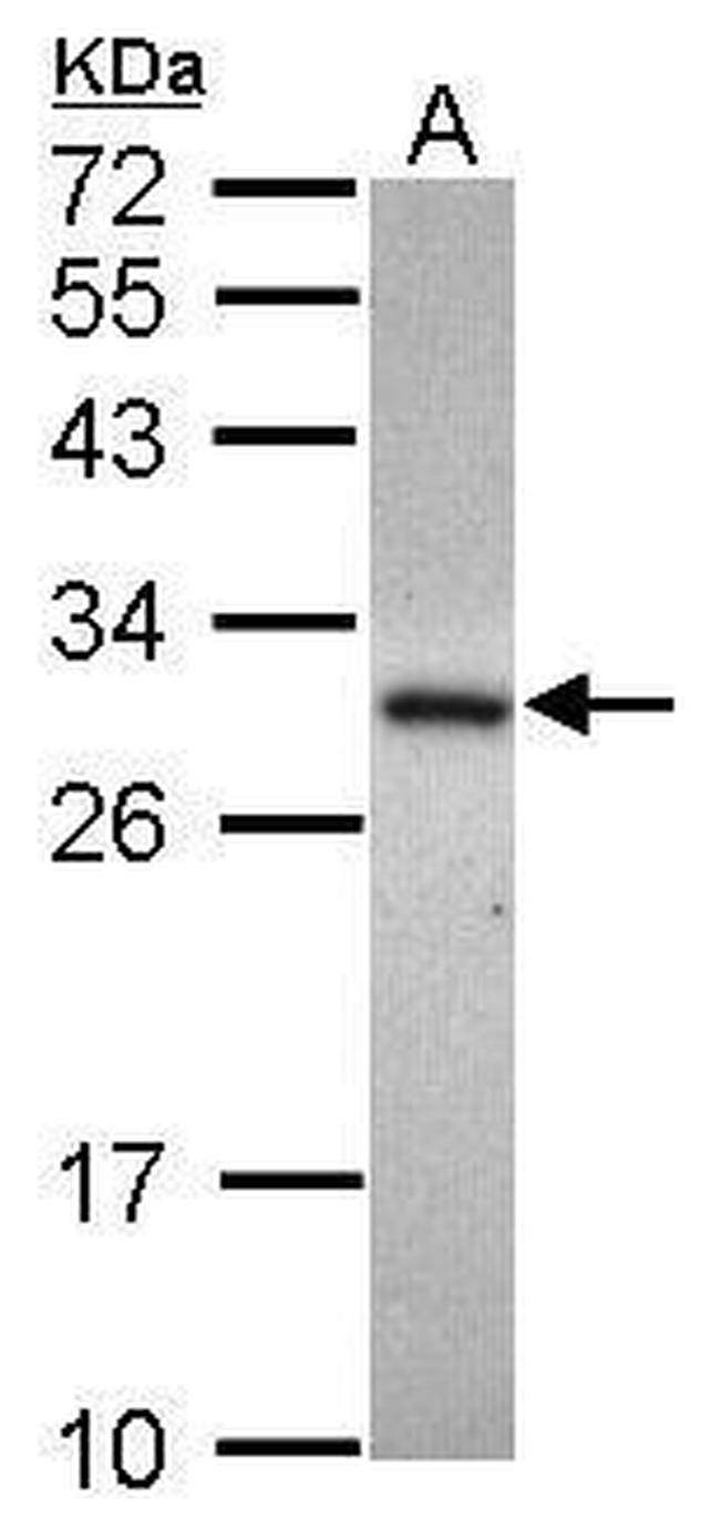 ADHFE1 Antibody in Western Blot (WB)