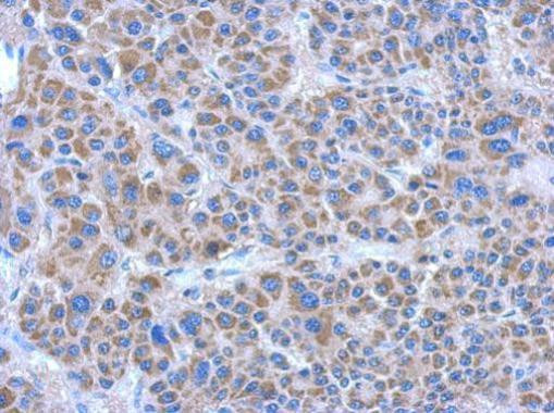 ADHFE1 Antibody in Immunohistochemistry (Paraffin) (IHC (P))