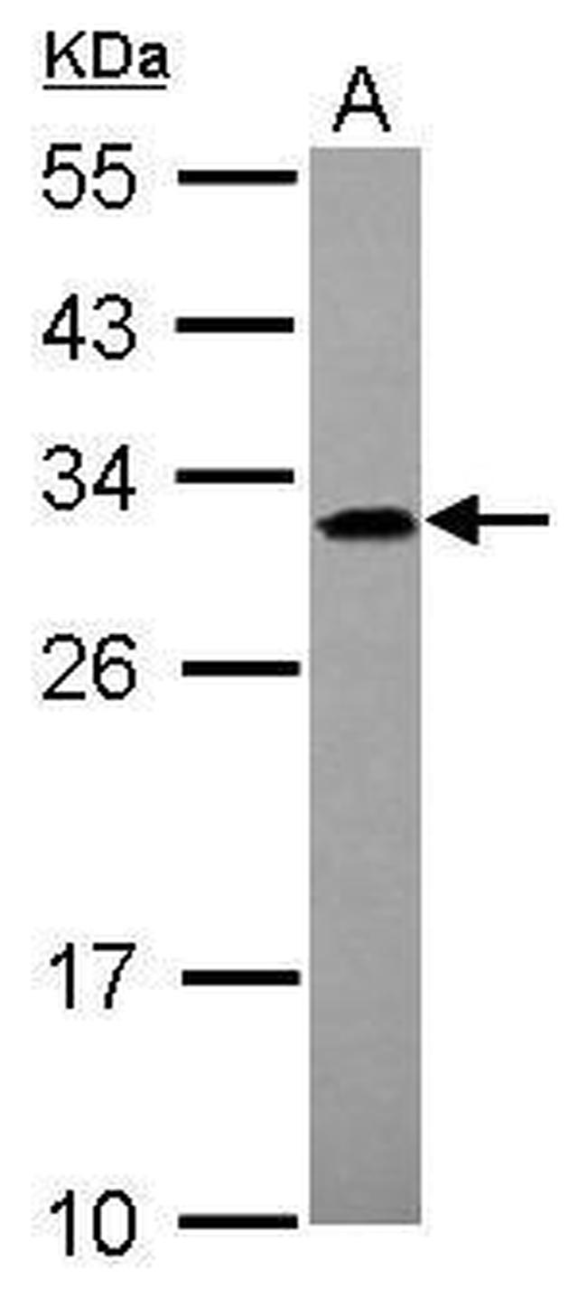 ADHFE1 Antibody in Western Blot (WB)