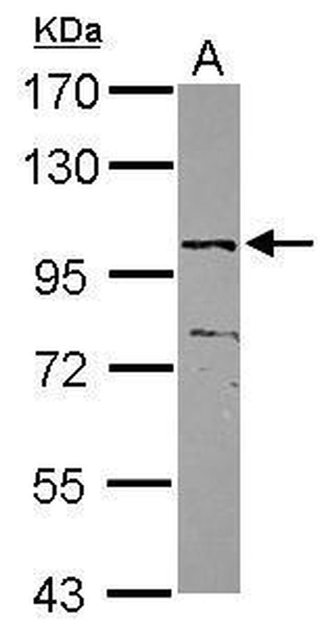 ZNF690 Antibody in Western Blot (WB)