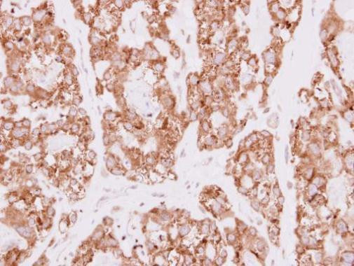 SDR16C5 Antibody in Immunohistochemistry (Paraffin) (IHC (P))