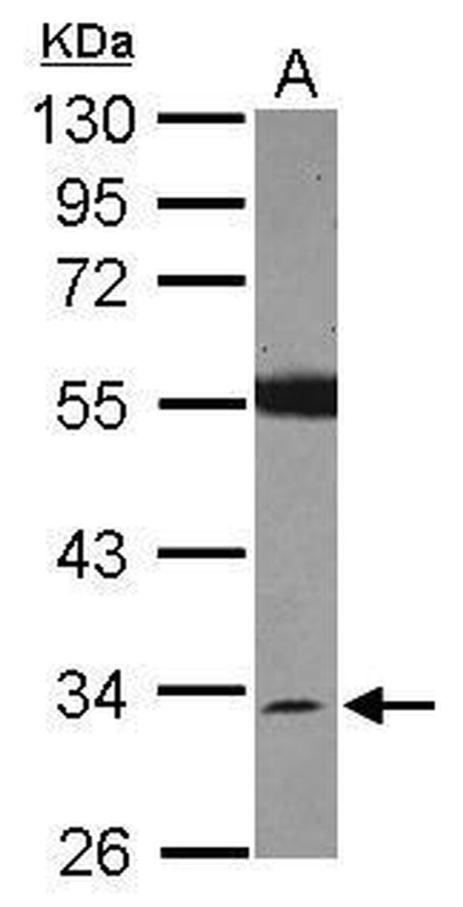 SDR16C5 Antibody in Western Blot (WB)