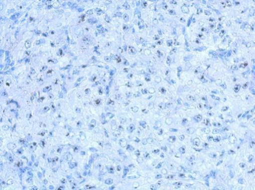 SALF Antibody in Immunohistochemistry (Paraffin) (IHC (P))