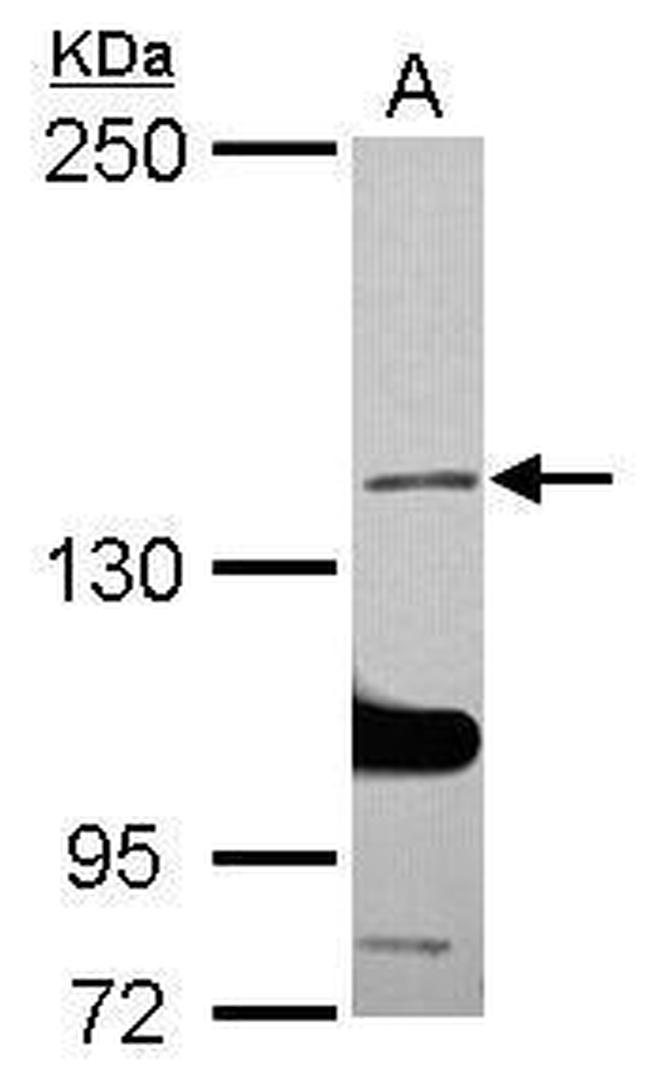 SALF Antibody in Western Blot (WB)