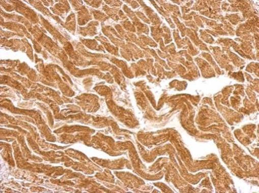 UBE2O Antibody in Immunohistochemistry (Paraffin) (IHC (P))