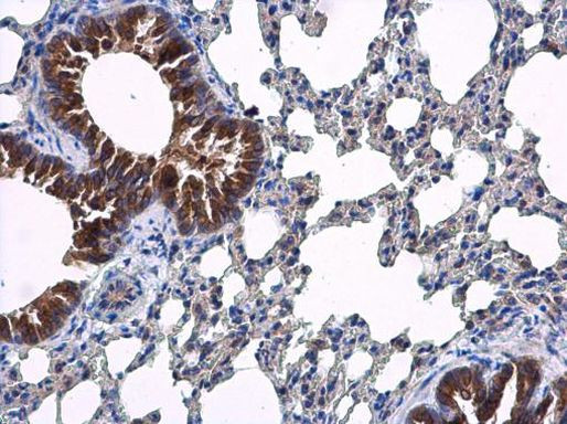 ARF5 Antibody in Immunohistochemistry (Paraffin) (IHC (P))