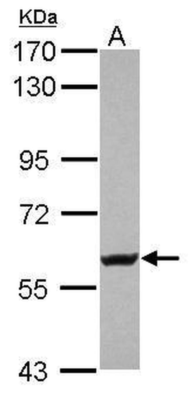 KV4.2 (KCND2) Antibody in Western Blot (WB)