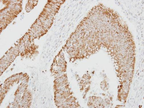 SERPINA4 Antibody in Immunohistochemistry (Paraffin) (IHC (P))