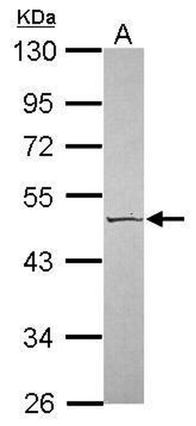 SERPINA4 Antibody in Western Blot (WB)