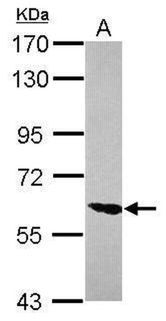 ZNF76 Antibody in Western Blot (WB)