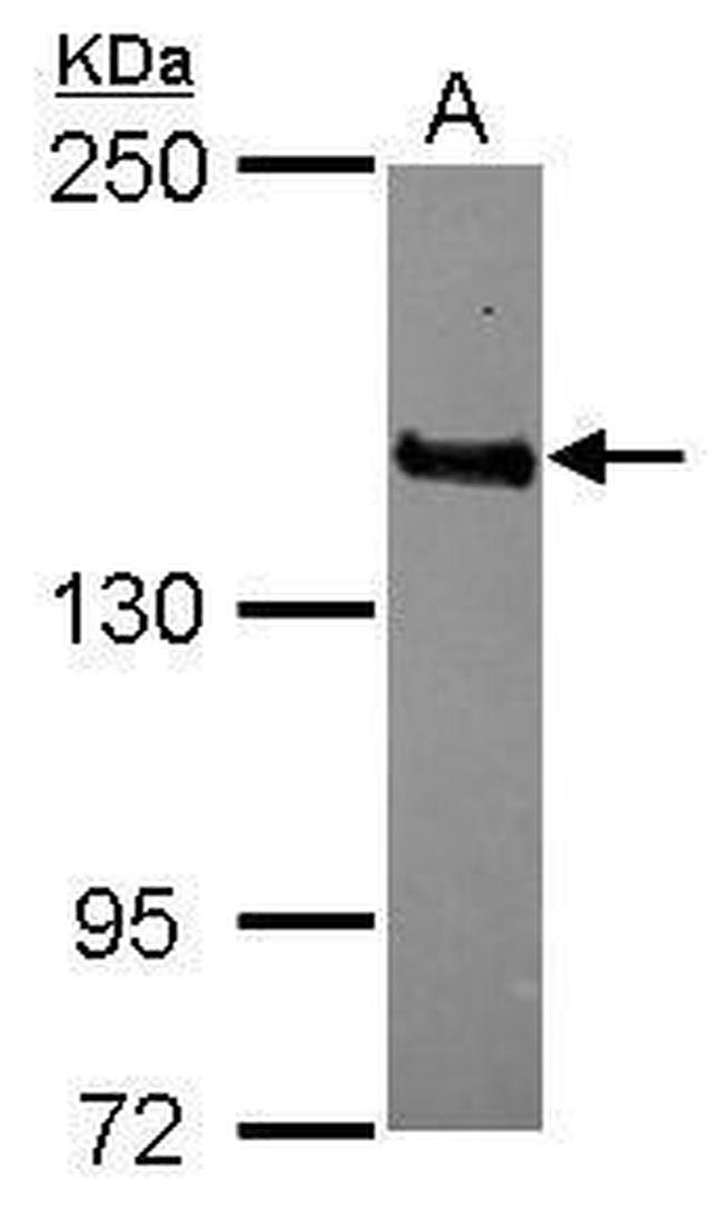 MAGI3 Antibody in Western Blot (WB)