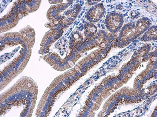 AAMP Antibody in Immunohistochemistry (Paraffin) (IHC (P))