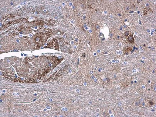 AAMP Antibody in Immunohistochemistry (Paraffin) (IHC (P))