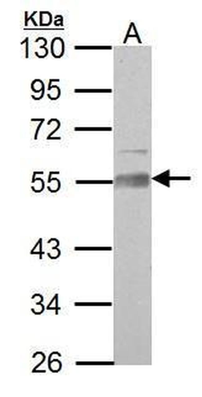 AAMP Antibody in Western Blot (WB)