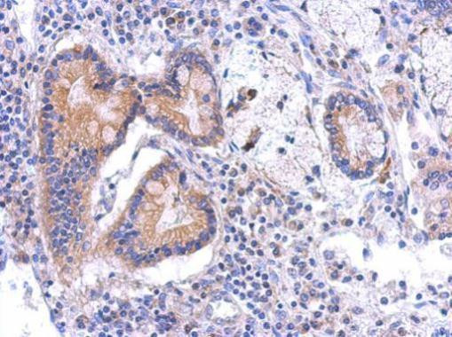 BCKDK Antibody in Immunohistochemistry (Paraffin) (IHC (P))