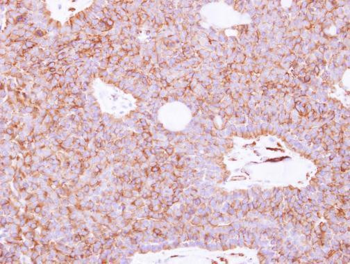 SIGLEC12 Antibody in Immunohistochemistry (Paraffin) (IHC (P))