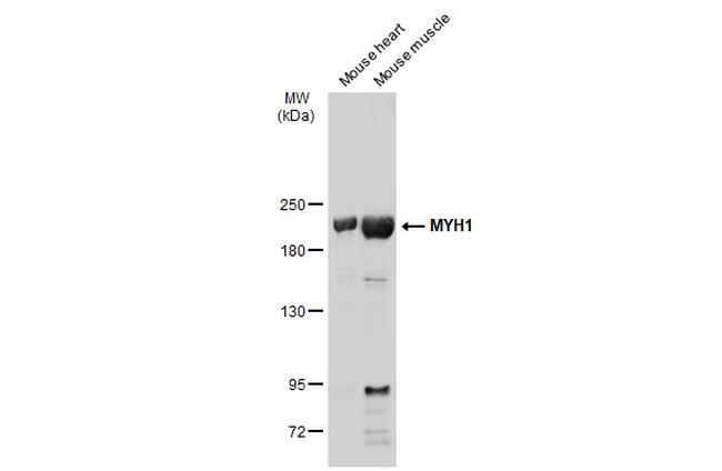 Myosin Skeletal Muscle Antibody in Western Blot (WB)