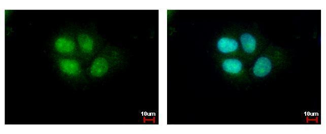 SETD8 Antibody in Immunocytochemistry (ICC/IF)