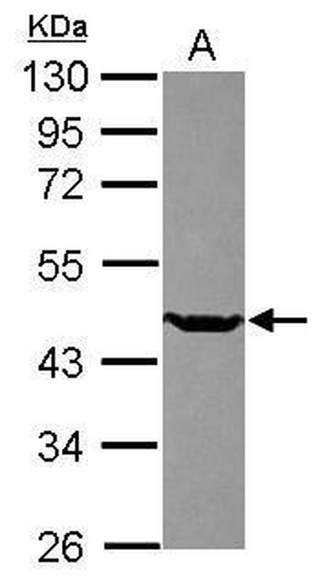 SETD8 Antibody in Western Blot (WB)