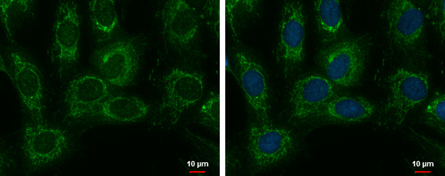 SARS2 Antibody in Immunocytochemistry (ICC/IF)