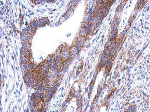 SARS2 Antibody in Immunohistochemistry (Paraffin) (IHC (P))