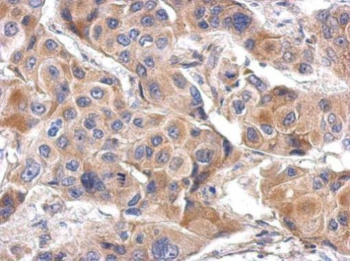 LILRA4 Antibody in Immunohistochemistry (Paraffin) (IHC (P))