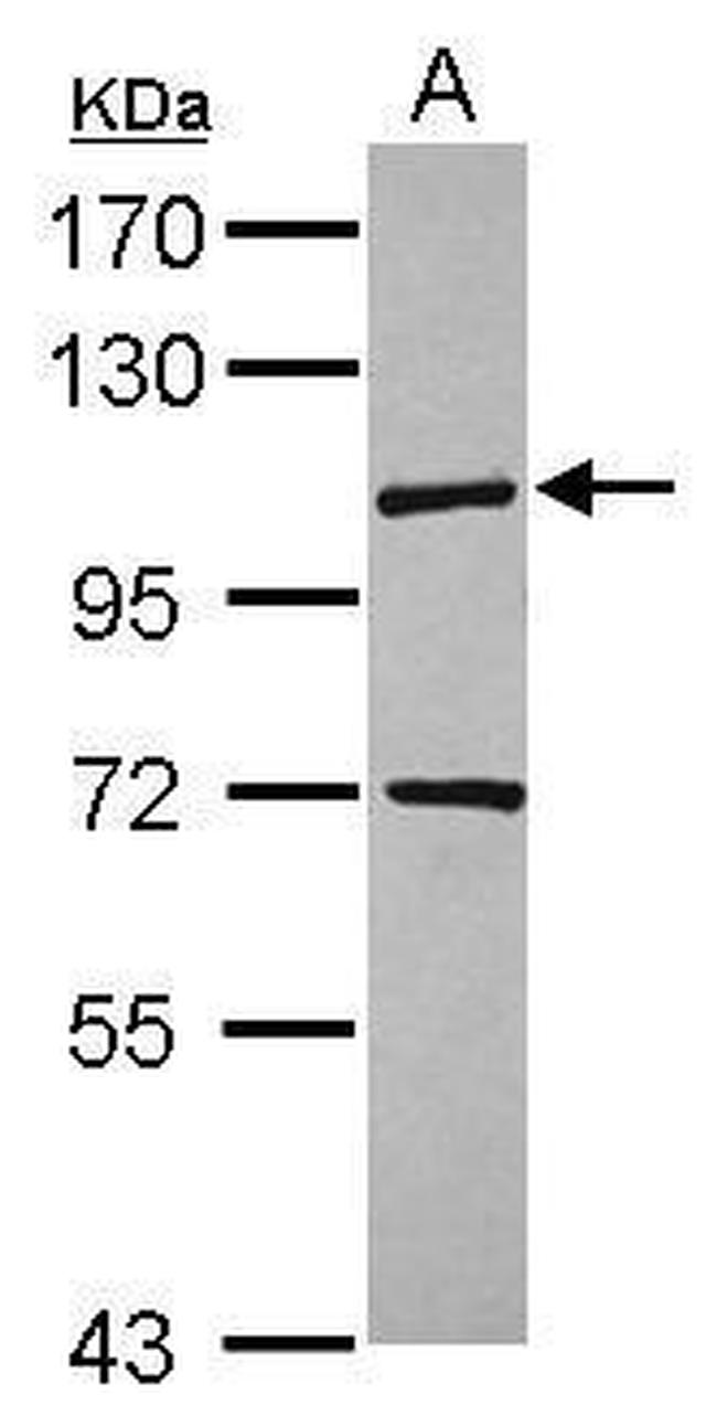 KIF18A Antibody in Western Blot (WB)