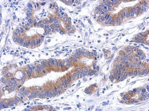 Annexin A8 Antibody in Immunohistochemistry (Paraffin) (IHC (P))