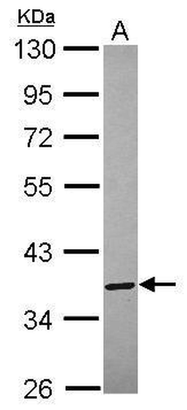 Annexin A8 Antibody in Western Blot (WB)