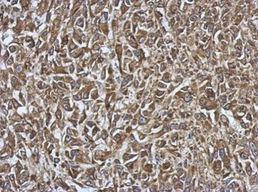 SMYD1 Antibody in Immunohistochemistry (Paraffin) (IHC (P))