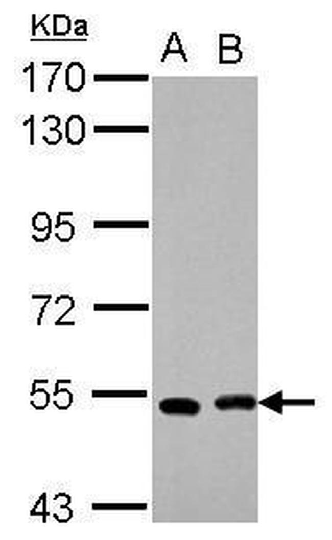 SMYD1 Antibody in Western Blot (WB)