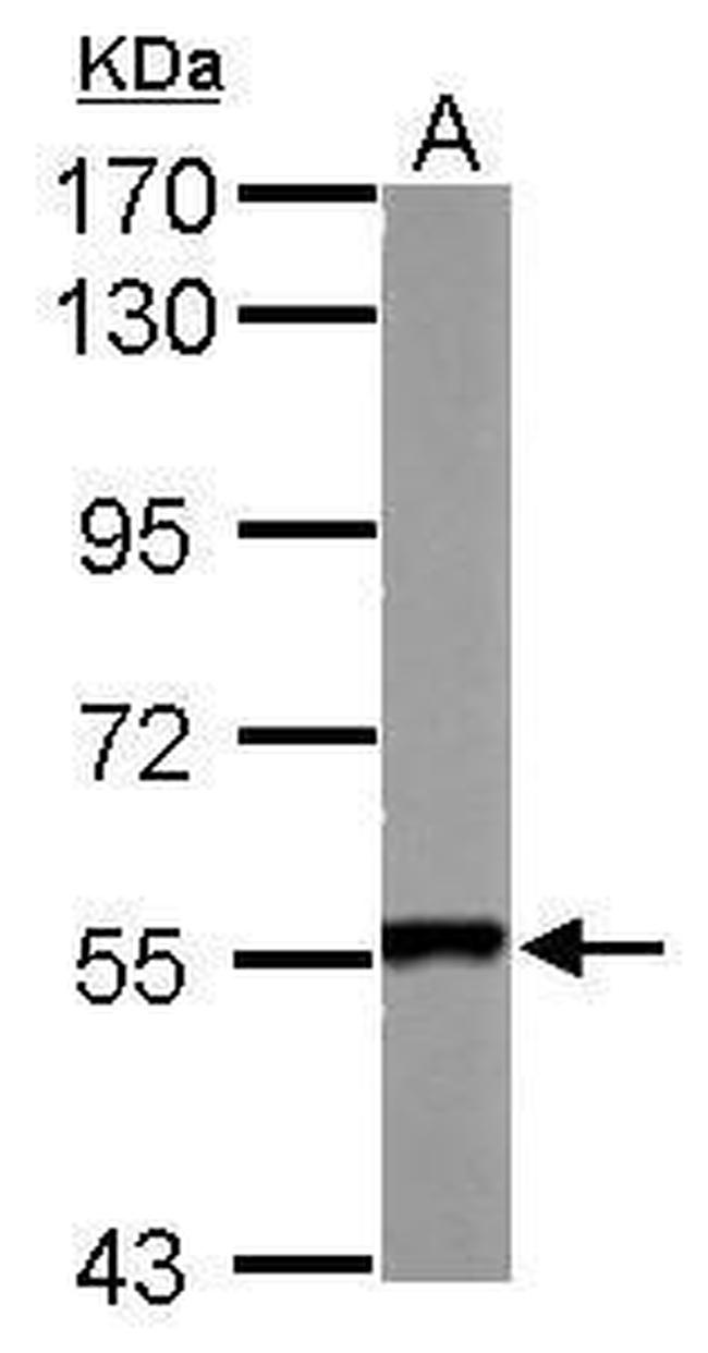 SMYD1 Antibody in Western Blot (WB)