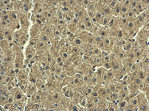 RAB20 Antibody in Immunohistochemistry (Paraffin) (IHC (P))