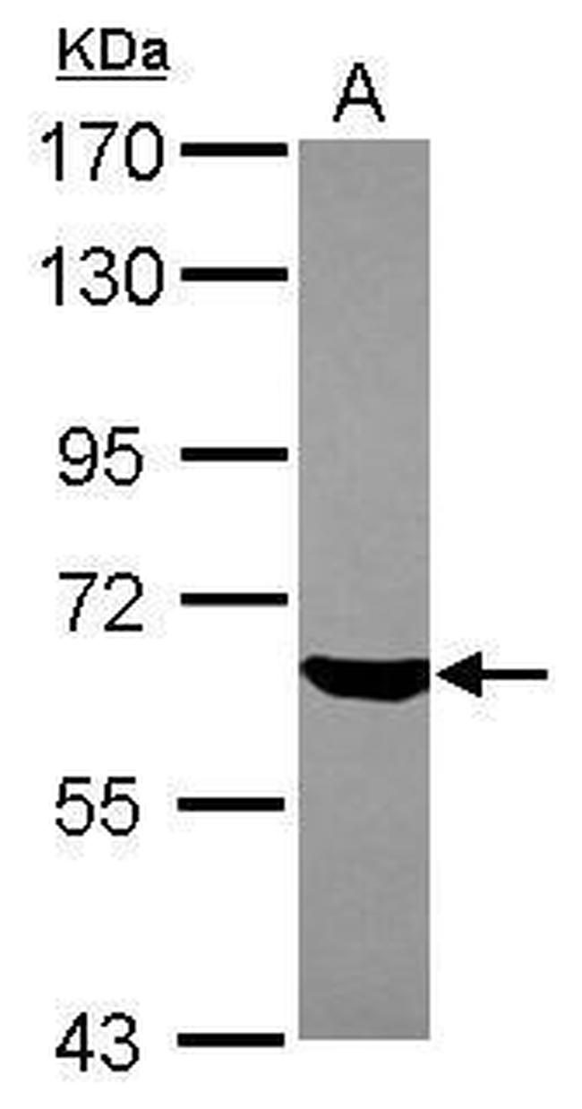 ZKSCAN4 Antibody in Western Blot (WB)